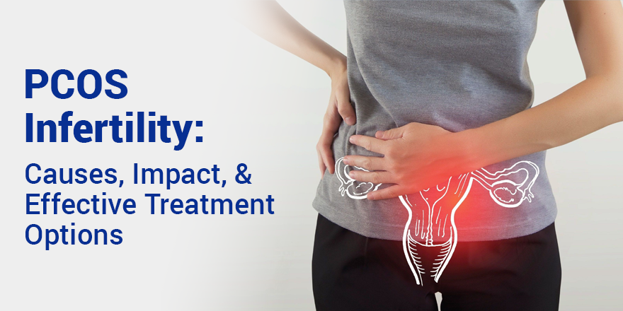 PCOS Infertility: Causes, Impact, and Effective Treatment Options